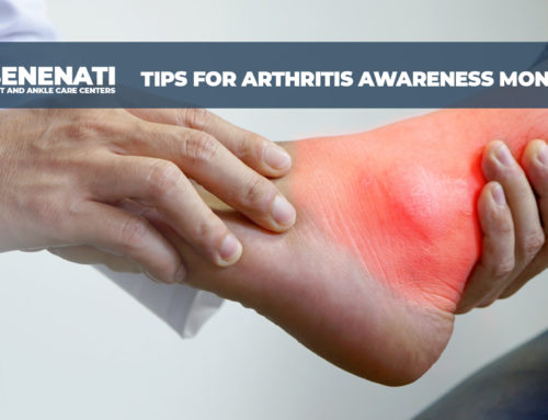 Tips for Arthritis Awareness Month