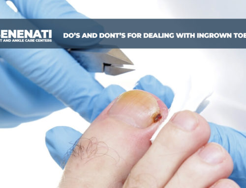 Do’s and Dont’s for Dealing with Ingrown Toenails