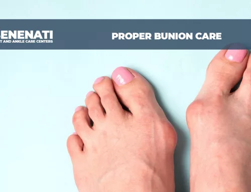 Proper Bunion Care