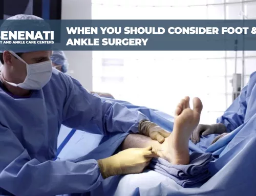 When You Should Consider Foot and Ankle Surgery