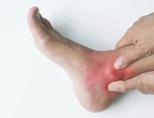 Lingering Ankle Pain: Why You Shouldn’t Ignore It