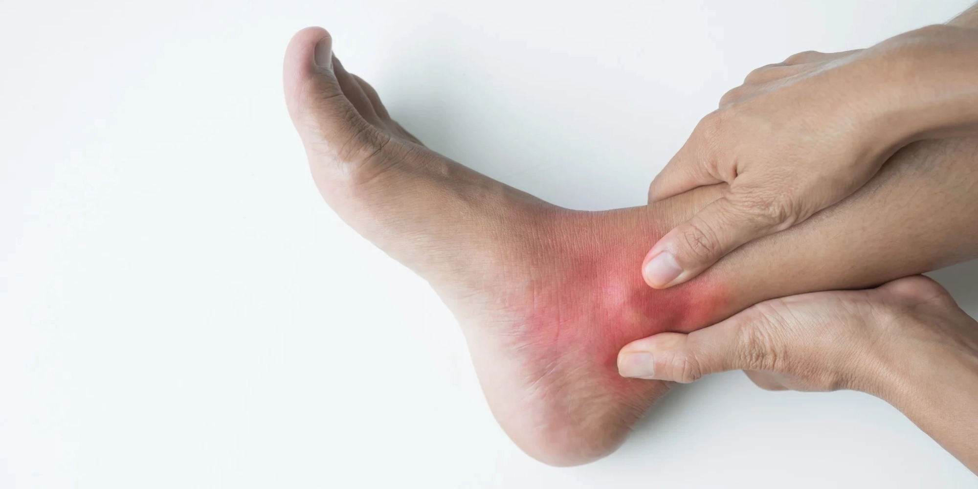 Patient holding swollen ankle during walking