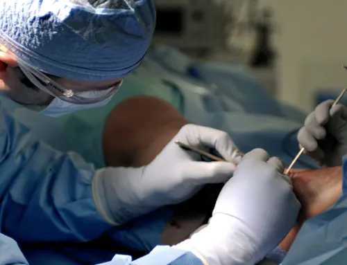 Why You Should See a Podiatric Surgeon for Bone & Joint Problems
