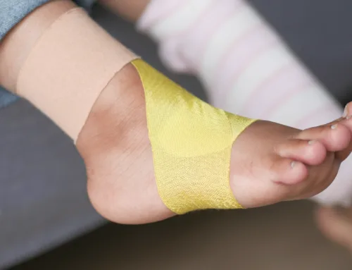 Stress Fractures: The Hidden Risk in Everyday Foot Pain